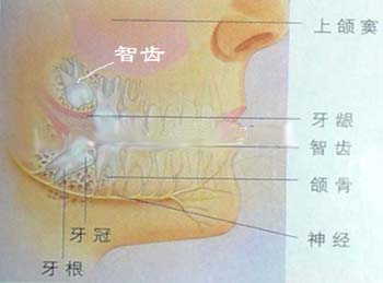 智齒磨口腔可以拔嗎(ma)