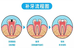 補牙三步有，健康跟我(wǒ)走！